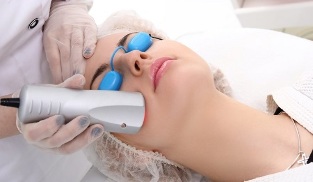 întinerire a pielii faciale cu laser