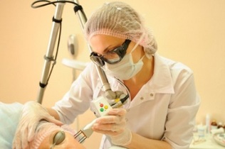 cum se efectuează procedura de întinerire fracțională a pielii cu laser 